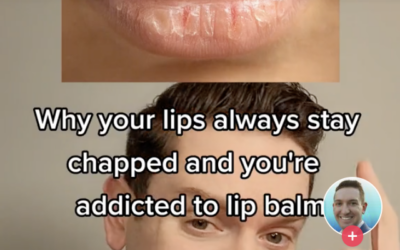 The Cause Of Your Dry Lips Is Actually Your Lip Balm